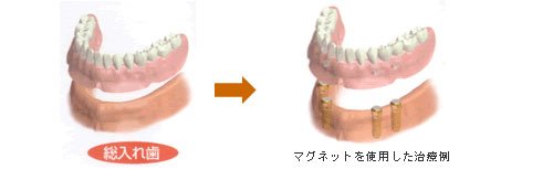 従来の治療方法との違いについて